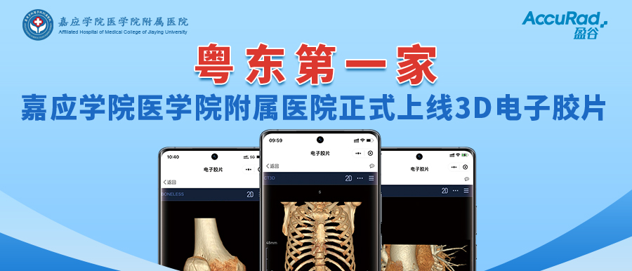 “手機掃一掃，云端影像隨時(shí)看”！盈谷網(wǎng)絡(luò )助力嘉應學(xué)院醫學(xué)院附屬醫院3D電子膠片正式上線(xiàn)！