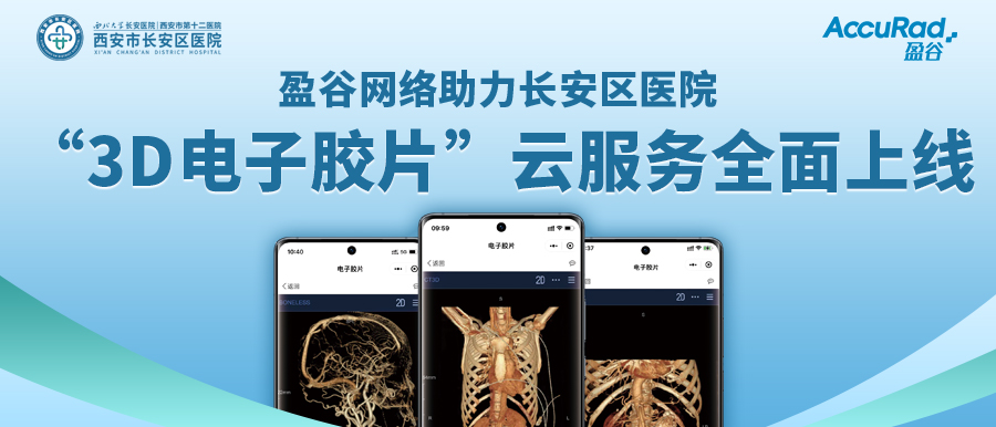 盈谷網(wǎng)絡(luò )助力長(cháng)安區醫院“3D電子膠片”云服務(wù)全面上線(xiàn)！診斷結果、影像資料隨時(shí)隨地看！